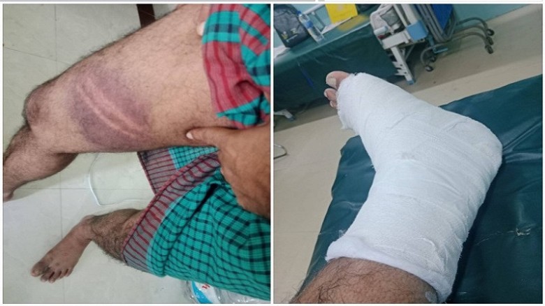 উত্তরায় জামাত নেতার কান্ড, কিডন্যাপ শেষে পিটিয়ে ভেঙে দিলেন পা